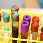 Blood samples used to assess kidney function and creatinine levels
