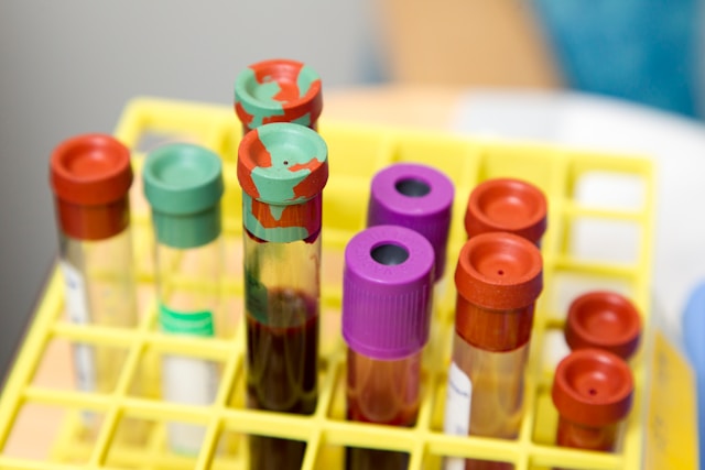 Blood samples used to assess kidney function and creatinine levels